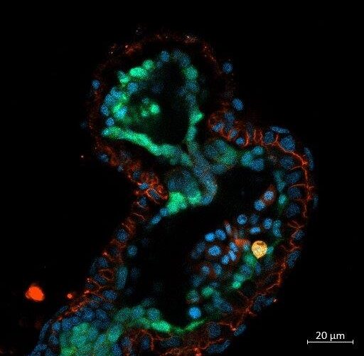 Stem cells and Development - Zebrafish Heart